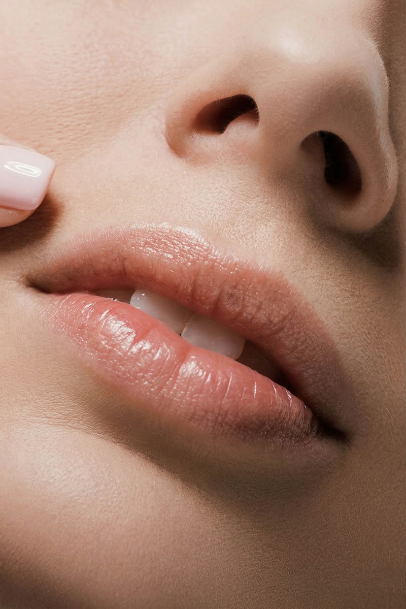 Cleft Lip